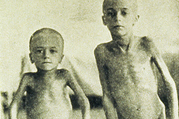 Emaciated children